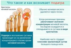 Подагра